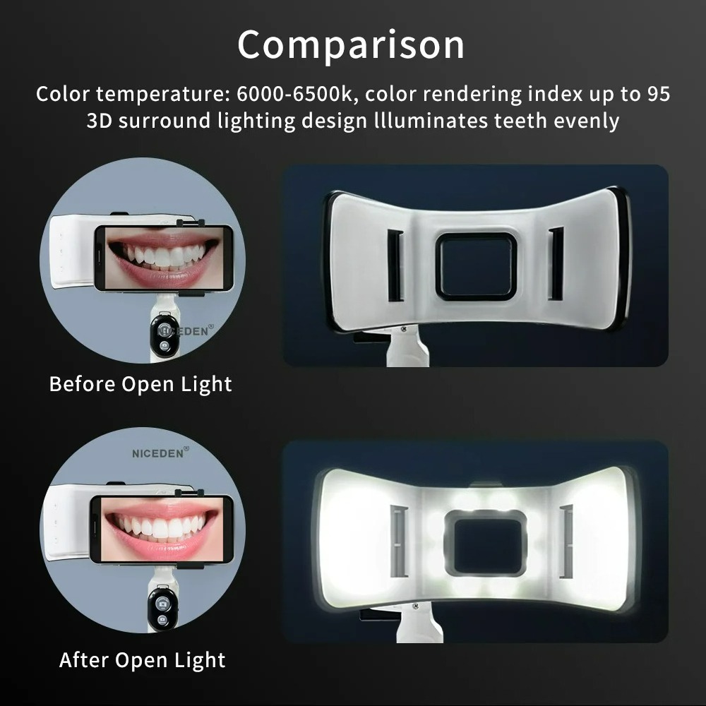 Dental Photography Light Phone - Phone Accessories For Photography recension och pris